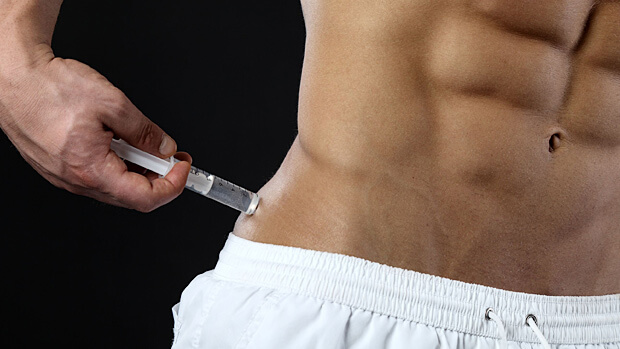 steroid-injections