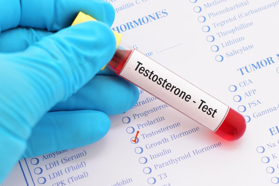 testosterone-blood-test